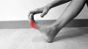 Read more about the article Gout 101: Understanding the Cause and Treatment